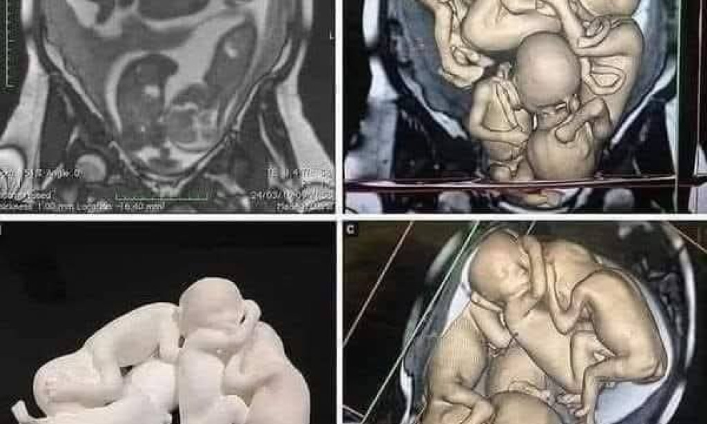 قصة واقعية فيها عبرة وعظة