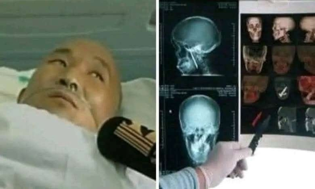 قصة المسكين كان يعاني من رائحة فمه الكريهة